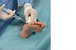 Hartmann Foliodrape® Protect Hand/Foot Set, 278004. Комплект для для хирургии стопы, кисти. 8 шт.