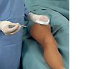 Hartmann Foliodrape® Protect Varicose Vein Set, 278012. Комплект варикозный. 6 шт.