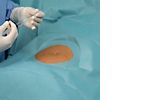 Hartmann Foliodrape® Protect Minor Surgery Set, 278003. Комплект для малой хирургии. 12 шт.
