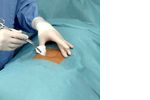 Hartmann Foliodrape® Protect Basic Set ambu, 278010. Основной амбулаторный комплект. 9 шт.