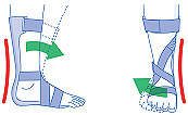 Динамический голеностопный ортез 