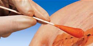 Hartmann Peha® Cotton Buds, 967950. Палочки с большим ватным тампоном, стерильные. 100 х 2 шт.