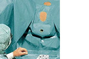 Hartmann Foliodrape® Protect Urology Set, 278007. Урологический комплект. 8 шт.