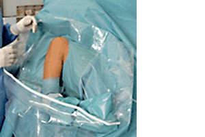Hartmann Foliodrape® Protect Shoulder Arthroscopy Set, 278008. Комплект для артроскопии плеча. 6 шт.