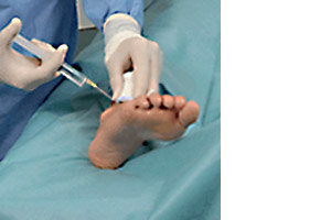 Hartmann Foliodrape® Protect Hand/Foot Set, 938723. Комплект для для хирургии стопы, кисти. 8 шт.